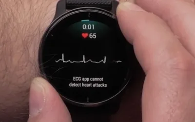 Garmin activa la función ECG en España en Venu 3, Fenix 8 y más