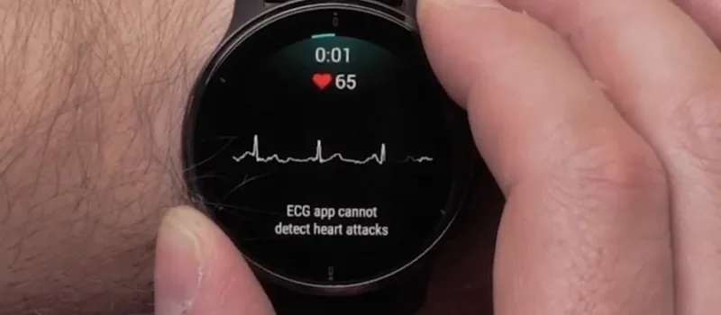 Garmin ecg espana 2025