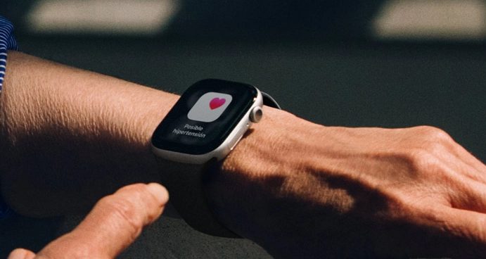 smartwatch deportivo Apple Watch Series 11